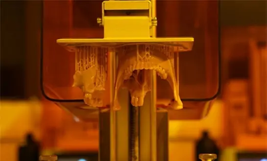 Which Stereolithography 3D Printer Is Best for Jewelry or Dental Use?